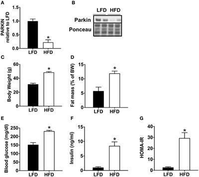 Decrease of Cardiac Parkin Protein in Obese Mice